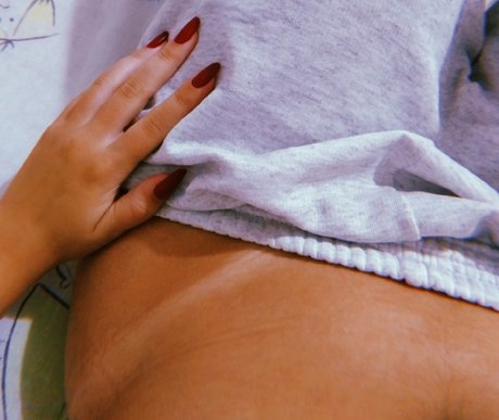 Patrcia Almeida