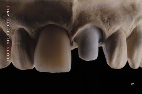 Naken läckt OnlyFans-bild av Onlydentistry