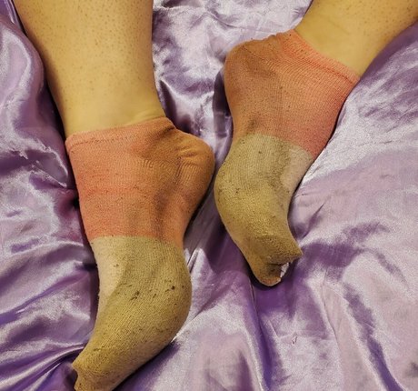 Missfeetstink