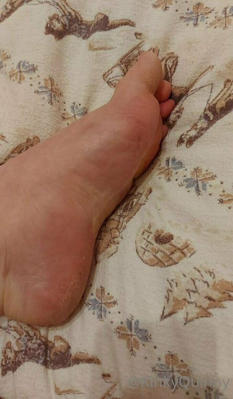 Kinkyquinny