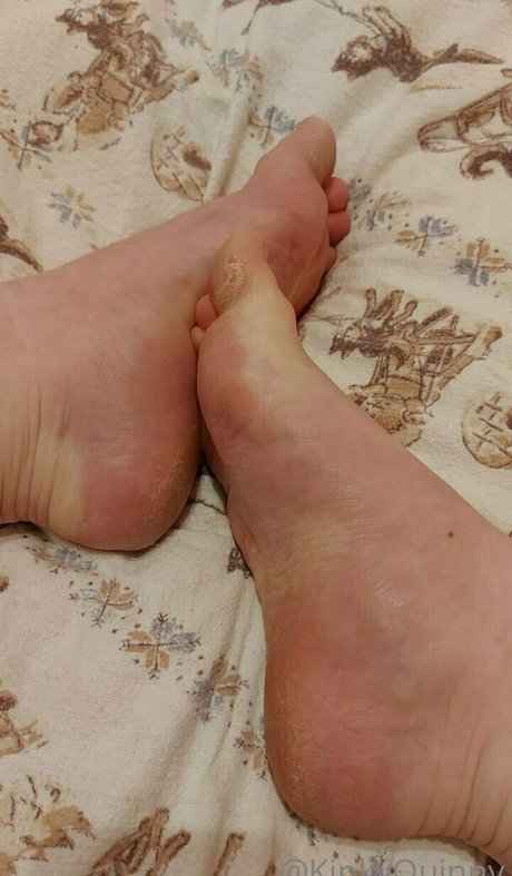 Kinkyquinny